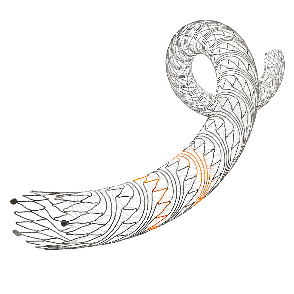 PRECISE® PRO RX™ Carotid Stent Delivery System