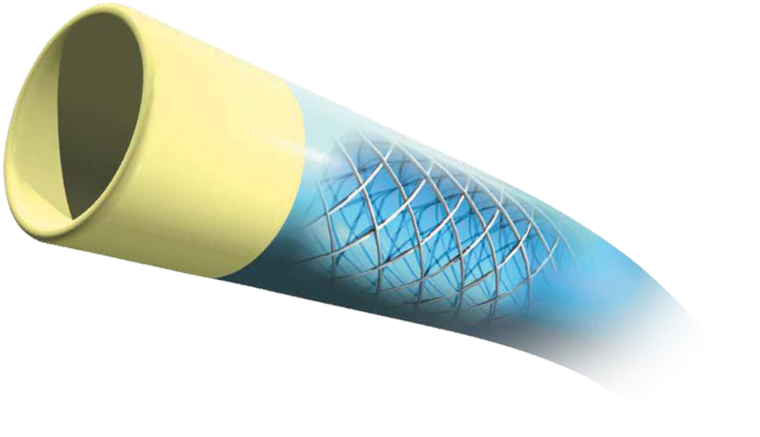 VISTA BRITE TIP® Guiding Catheter – Amplatz Right (AR)